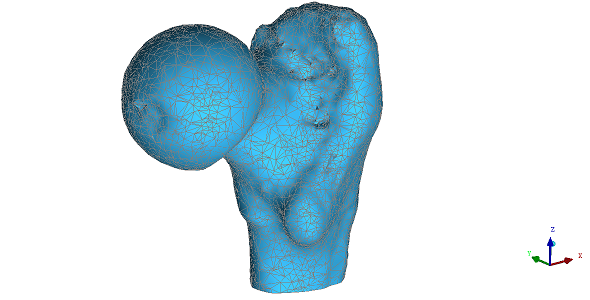 医療用画像から生成された大腿骨のポリゴン