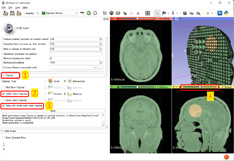 メッシュの表示