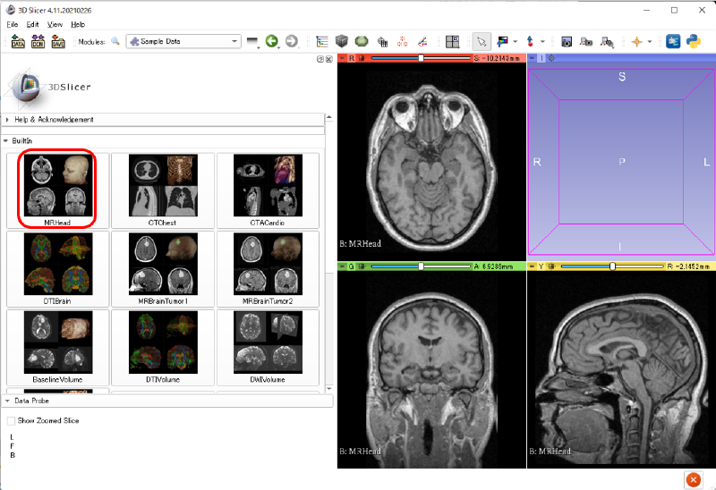 MRHeadの読み込み
