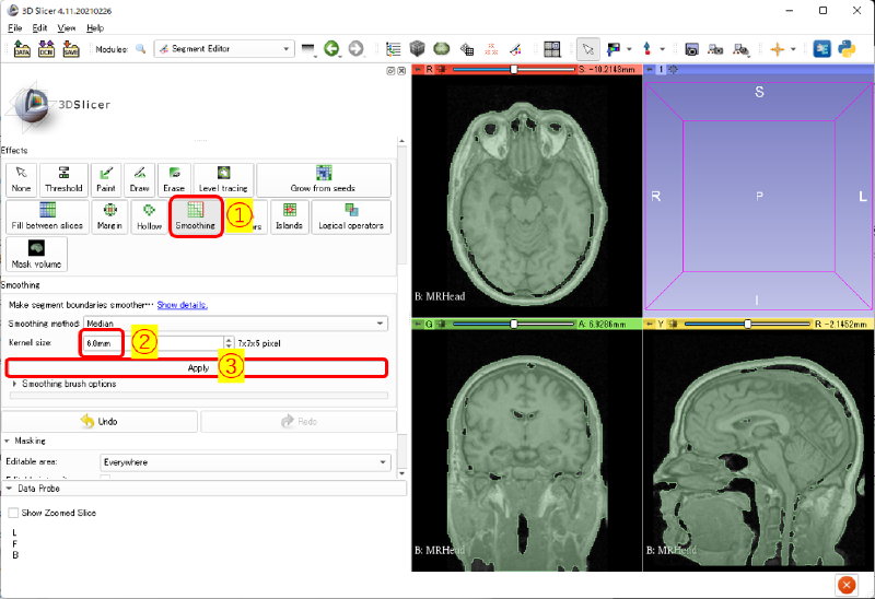 セグメンテーションのスムージング