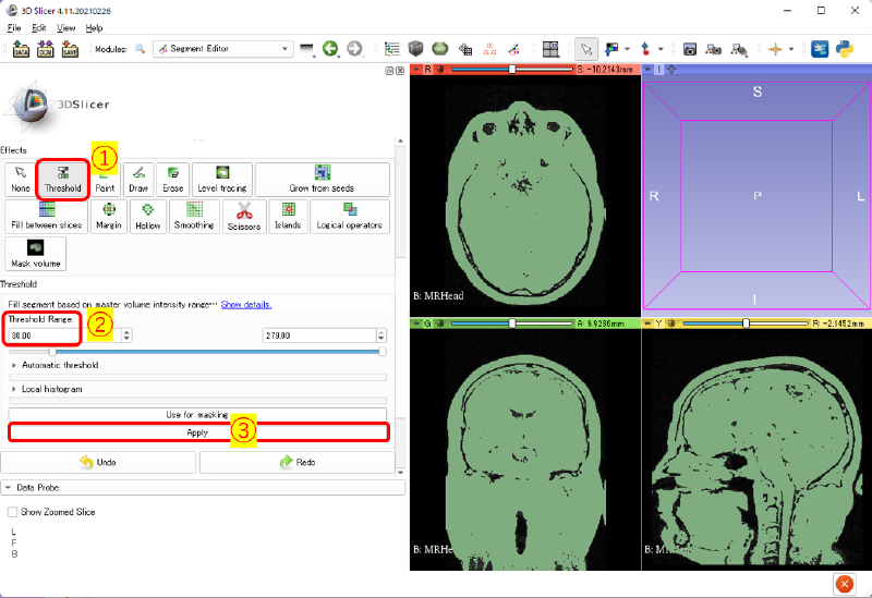頭部のセグメンテーション